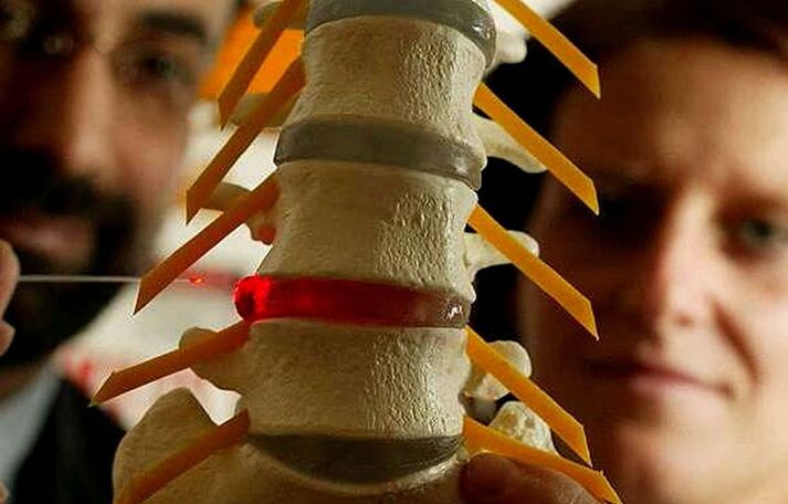 Cambios en la integridad del disco intervertebral