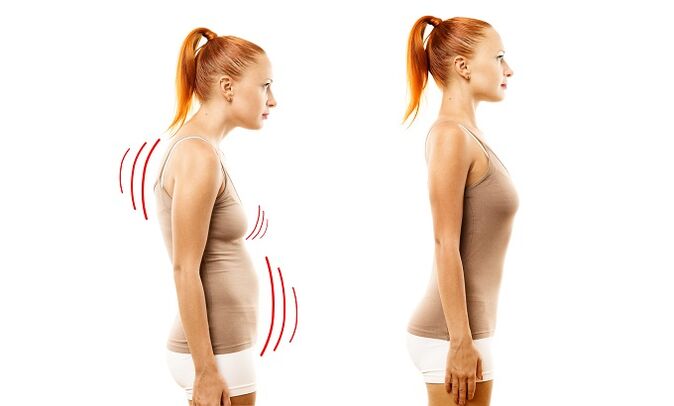 doblar como fuente de desarrollo de la osteocondrosis lumbar