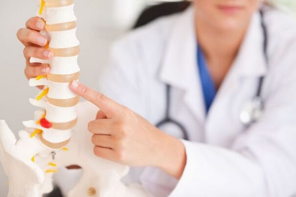 El médico muestra un modelo de la columna.