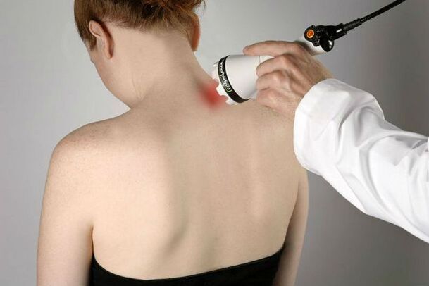Medidas de fisioterapia para el tratamiento de la osteocondrosis cervical.