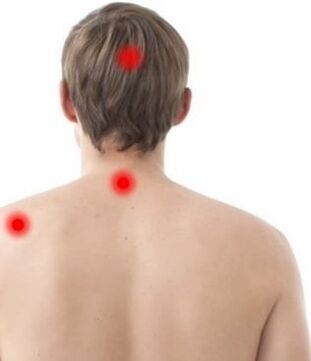 lugar del dolor en la osteocondrosis cervical