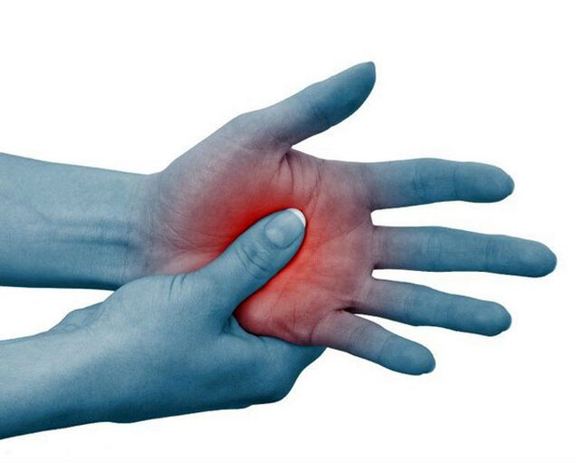 El dolor intenso en las articulaciones de los dedos, que se alivia con el ejercicio, es un signo típico de artritis reumatoide.